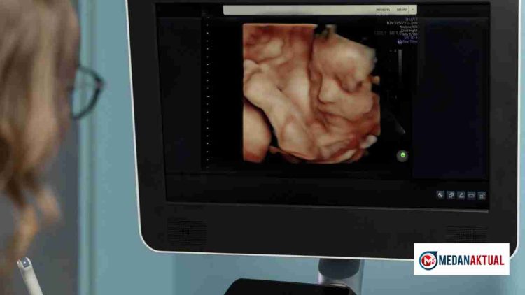 Dokter Kandungan Terbaik di Depok yang Banyak Dicari